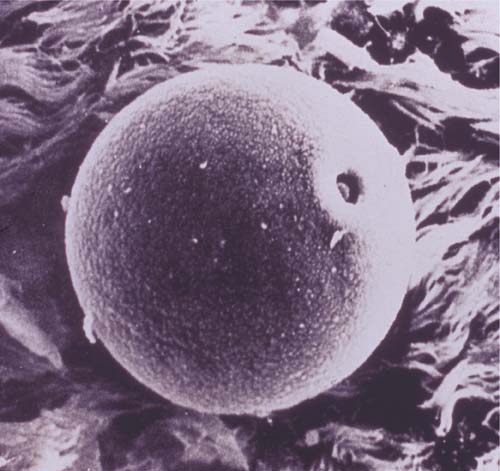 Graspollen onder de microscoop (Foto: American Academy of Allergy, Asthma & Immunology)